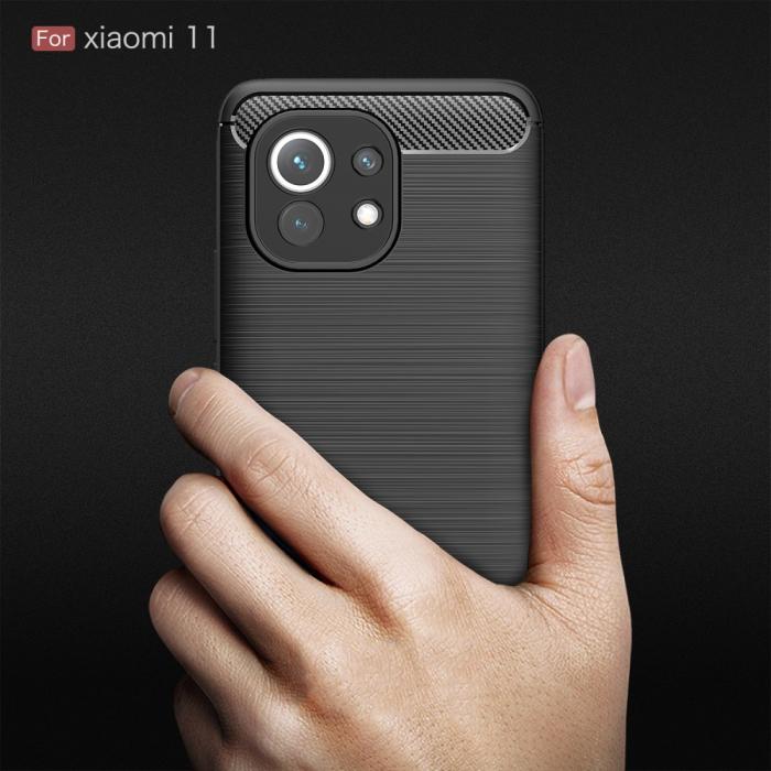A-One Brand - Carbon Fiber Mobilskal Til Xiaomi Mi 11 - Svart
