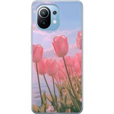 iSecrets - Mobilskal till Xiaomi Mi 11 med Rosa Tulpaner