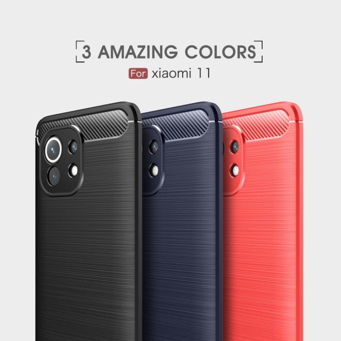 OEM - Carbon Fiber Mobilskal Til Xiaomi Mi 11 - Svart