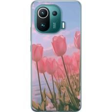iSecrets - Mobilskal till Xiaomi Mi 11 Pro med Rosa Tulpaner